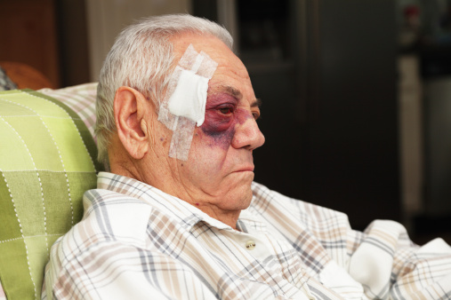 A senior man with a dreadful blotchy black and blue (and red) eye also has a large bandage covering several medical stitches in his temple